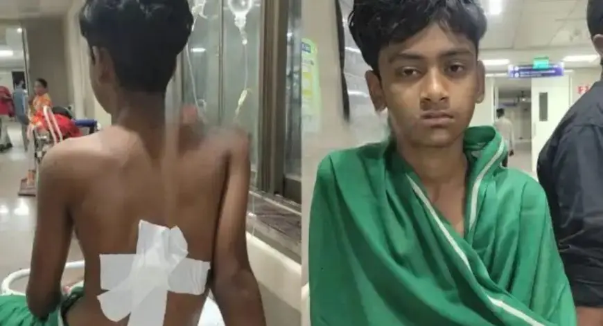 Kapali Stabbing: कपाली में क्रिकेट मैदान पर मजाक का खौफनाक अंत, 14 साल के ज़ैद की पीठ में घोंपा डैगर, एमजीएम अस्पताल में भर्ती