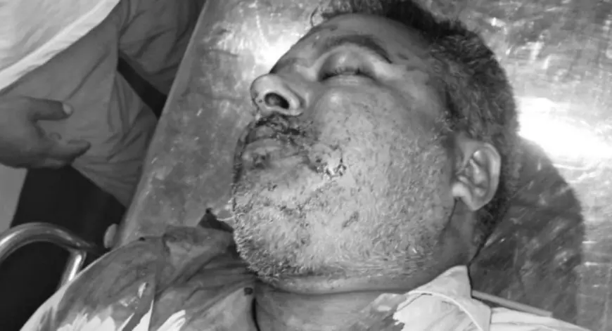 Bagbeda Murder: रेलवे स्टेशन के पास लोको पायलट की गोली मारकर हत्या, सीने में लगी गोली