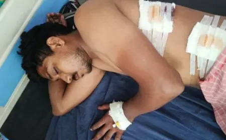 Palamu Crime:पलामू में युवक पर चाकू से ताबड़तोड़ हमला, फुआ के घर गया था दिनेश, आरोपी भोलू फरार