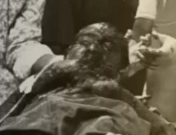 Sidhgora Drug Horror: नशे के पैसे न देने पर बेटे ने पिता पर चापड़ से किया जानलेवा हमला, अस्पताल में भर्ती