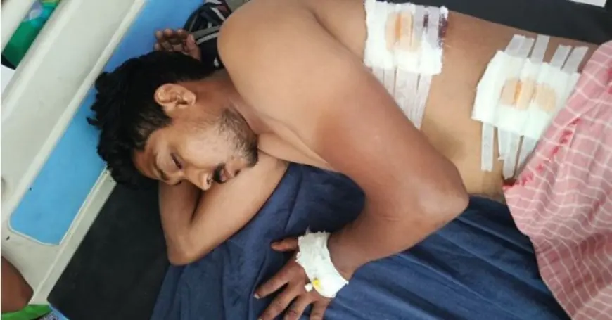 Palamu Crime:पलामू में युवक पर चाकू से ताबड़तोड़ हमला, फुआ के घर गया था दिनेश, आरोपी भोलू फरार
